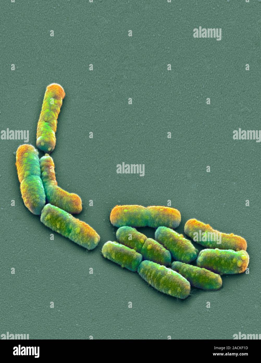 E. coli bacteria. Coloured scanning electron micrograph (SEM) of ...