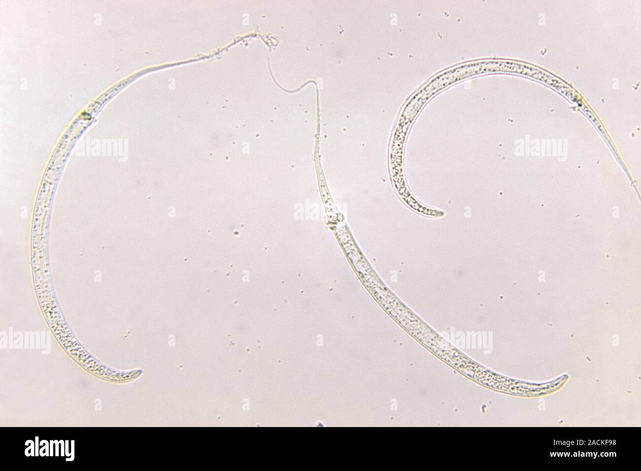 Guinea worm larvae. Light micrograph of three Guinea worms