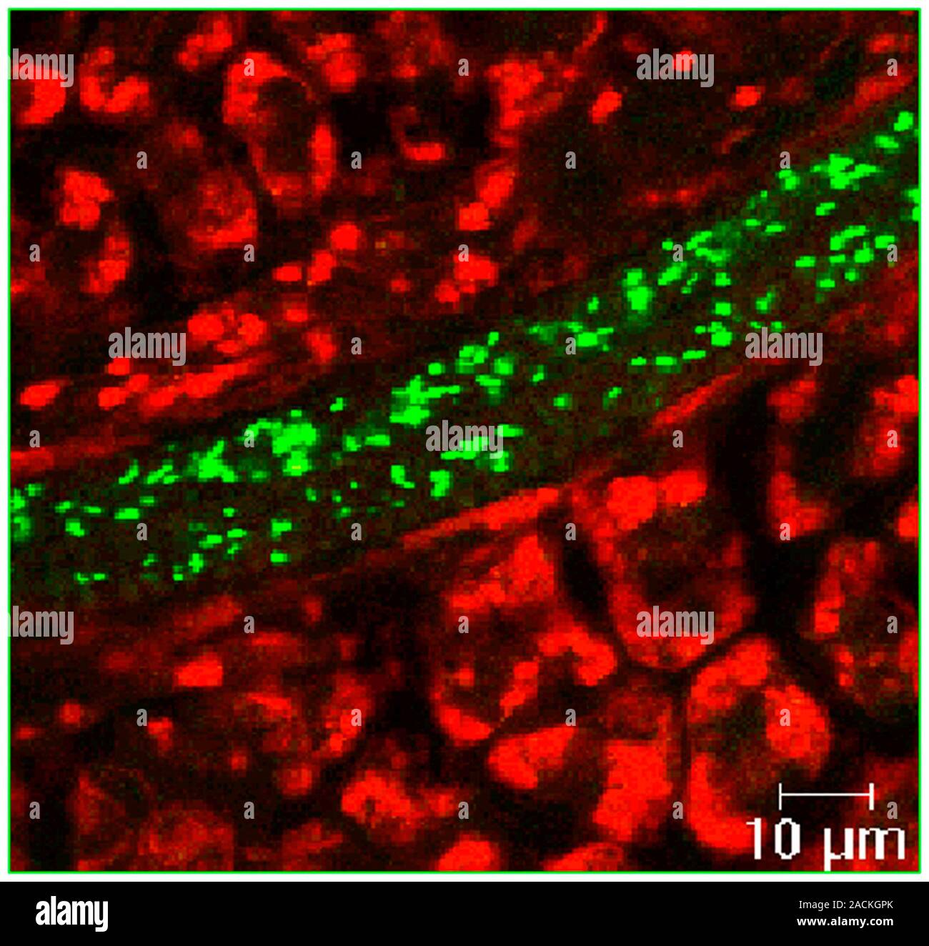 E. coli in lettuce. Confocal scanning laser micrograph of a section