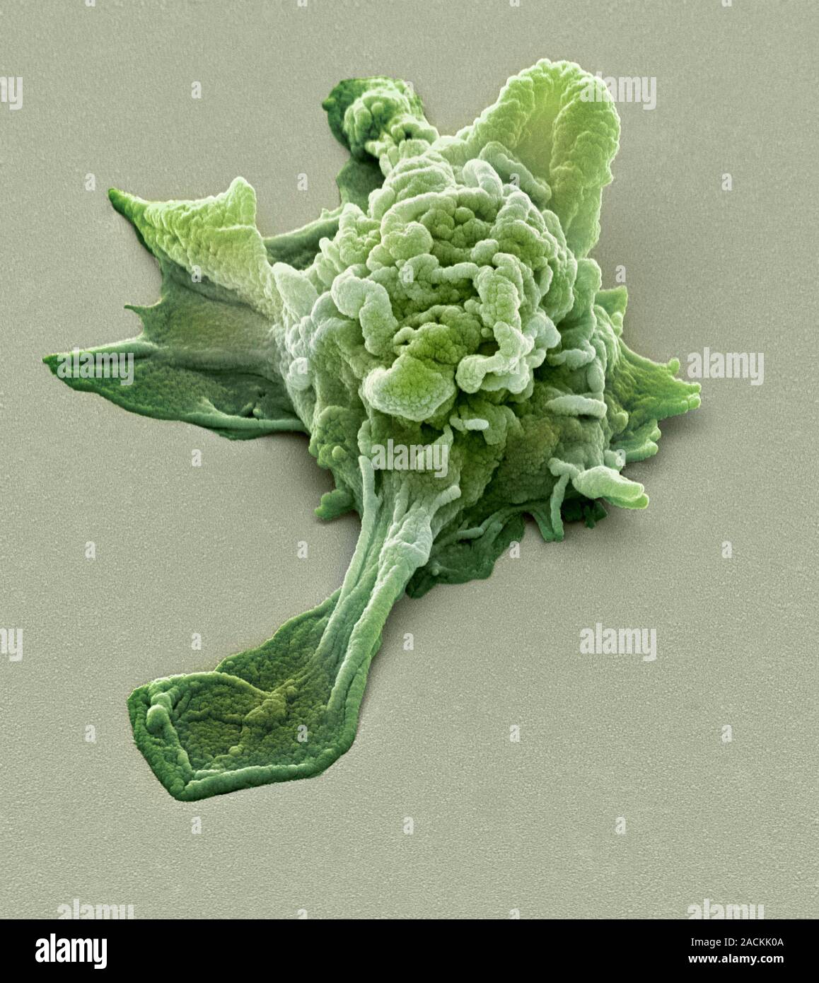 Activated granulocyte. Coloured scanning electron micrograph (SEM) of