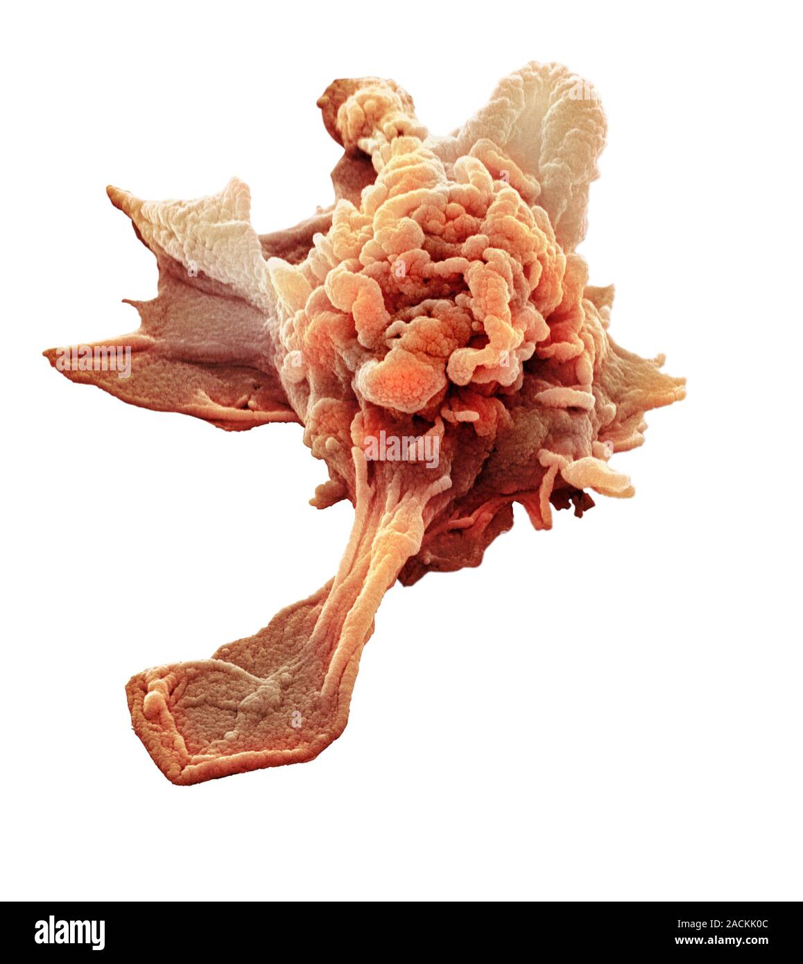 Activated granulocyte. Coloured scanning electron micrograph (SEM) of ...