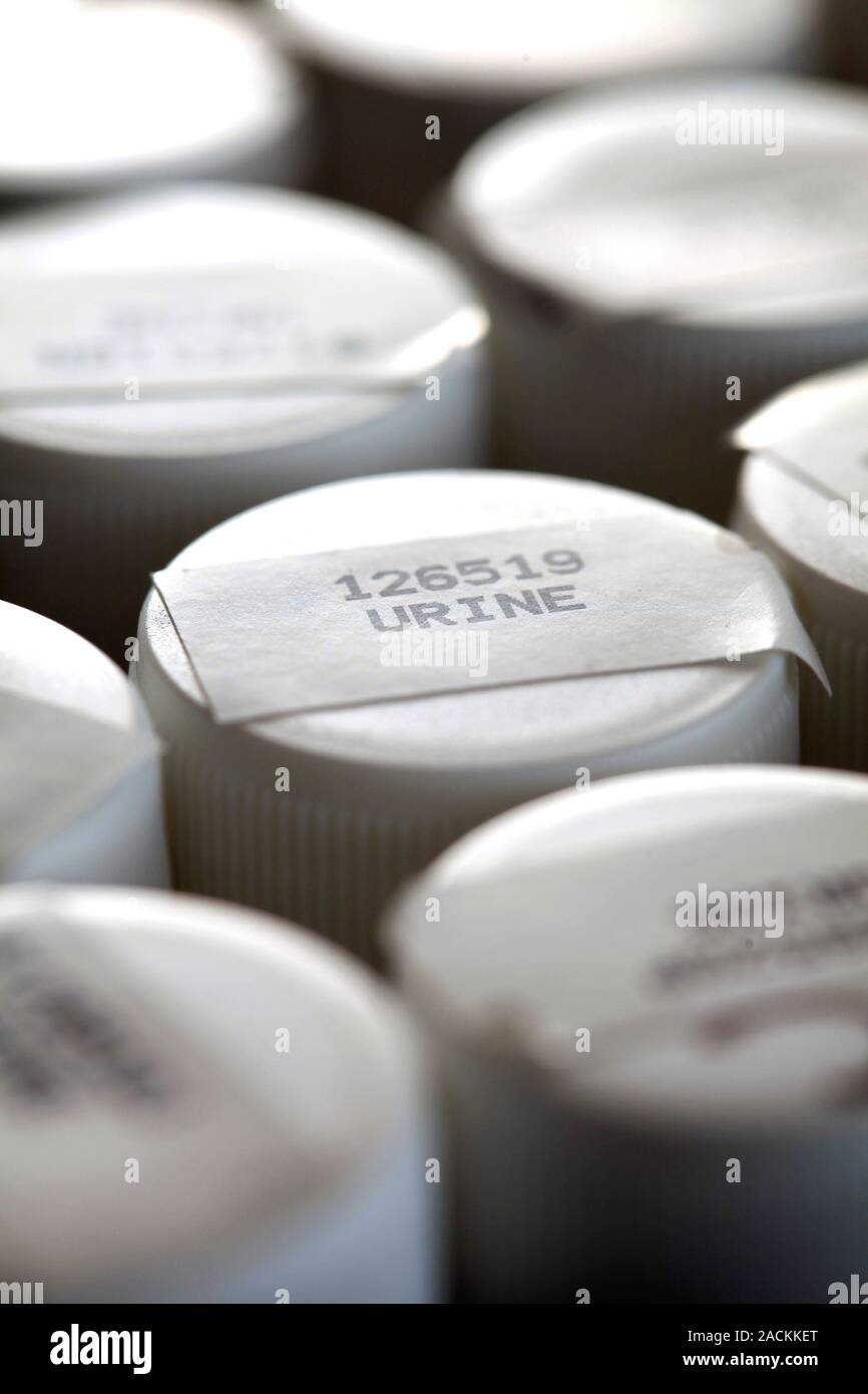 Samples of urine are stacked in trays before being tested for bacterial