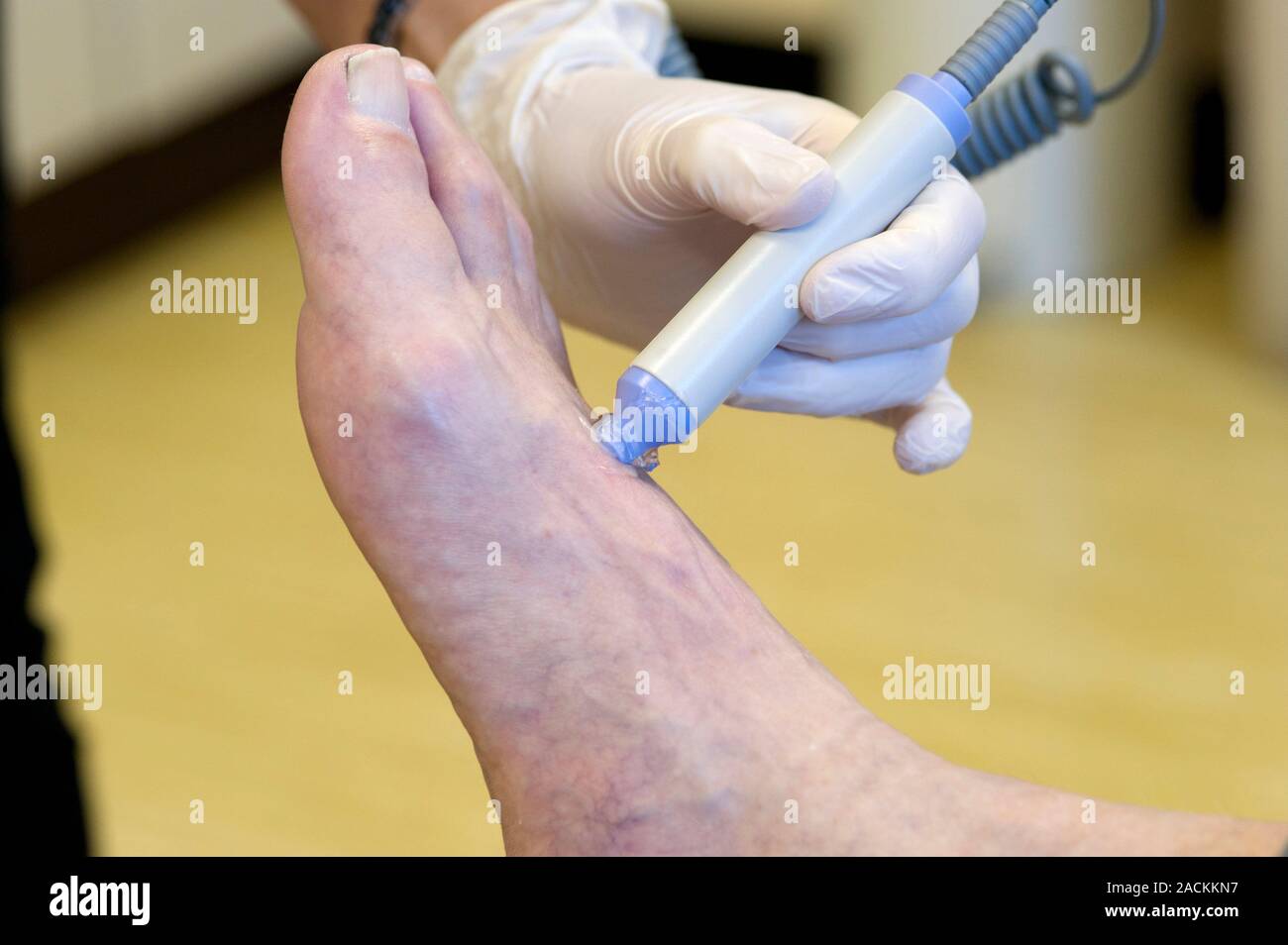 Gloved hand of a doctor uses a portable Doppler ultrasound device to