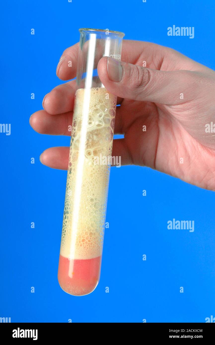 Acidbase reaction with indicator. Reaction in a test tube of lemon