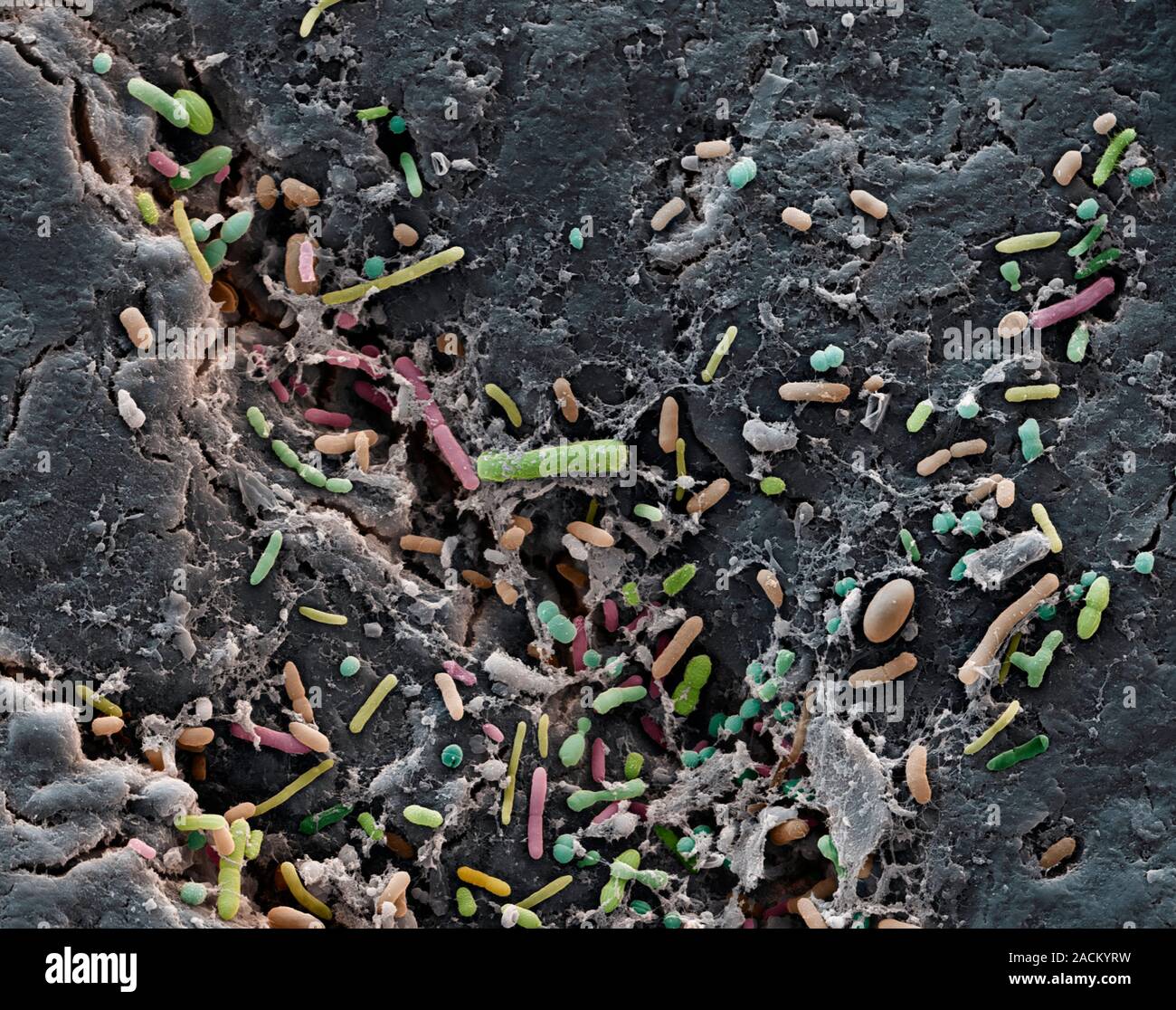 Intestinal bacteria. Scanning electron micrograph (SEM) of various