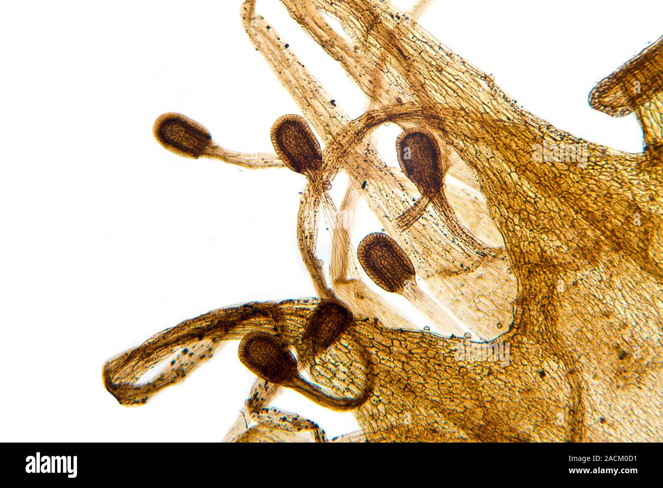 Common sundew. Light micrograph of a section through the leaf of a