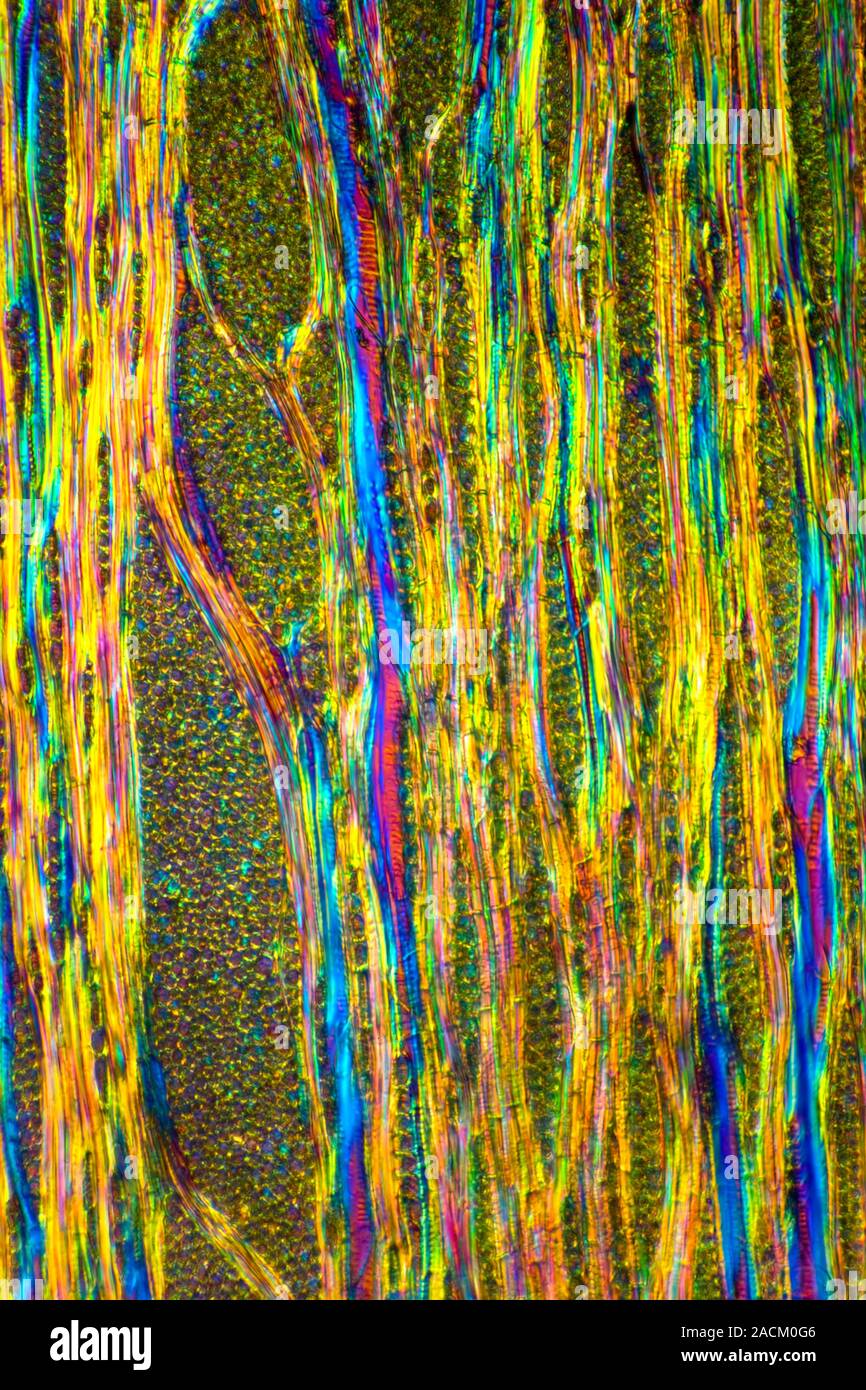 Beech tree stem. Polarised light micrograph of a section through the ...