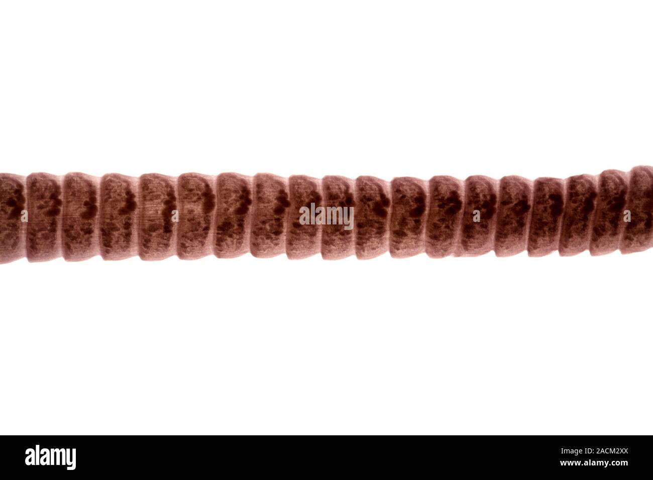 Dwarf tapeworm. Light micrograph of part of a dwarf tapeworm (Hymenolepis nana), showing the