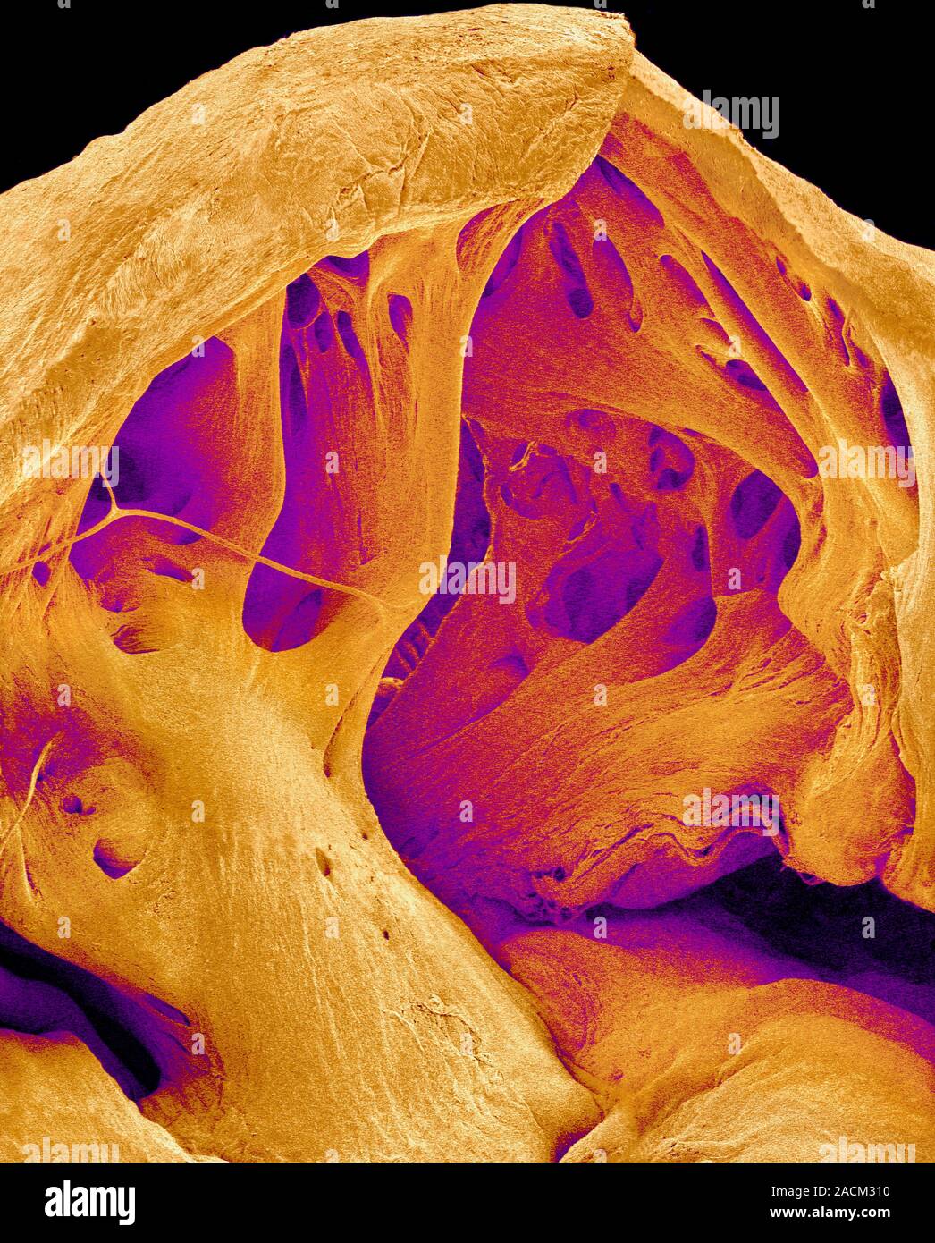 Heart muscle. Coloured scanning electron micrograph (SEM) of pectinate muscles in the wall of
