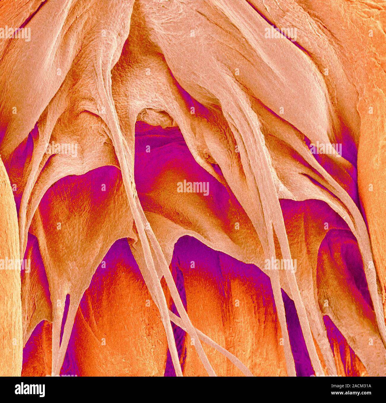 Heart valve and strings, coloured scanning electron micrograph (SEM ...