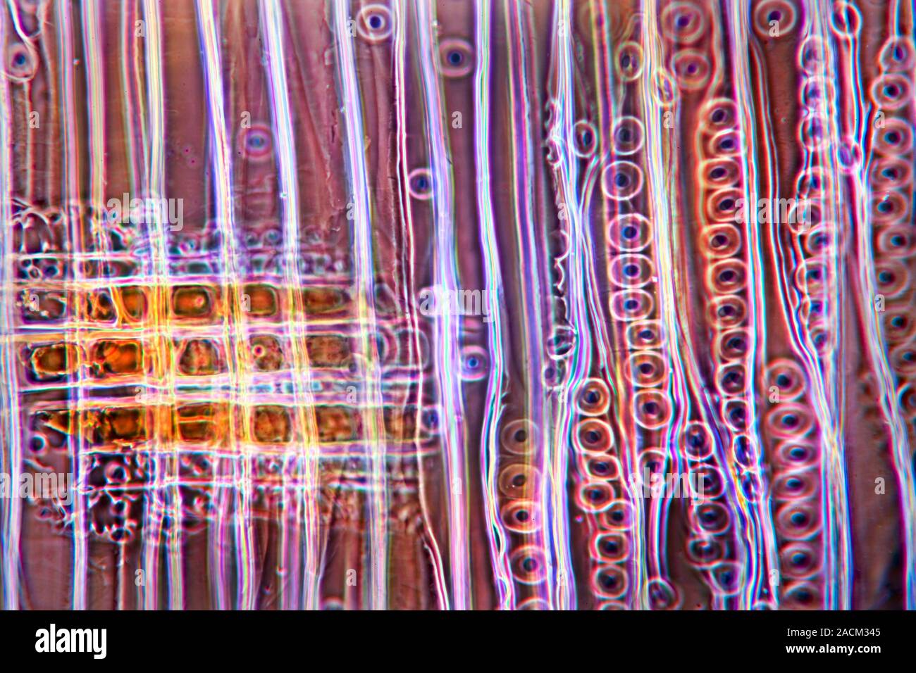 Pine stem. Light micrograph of a section through the stem of a pine