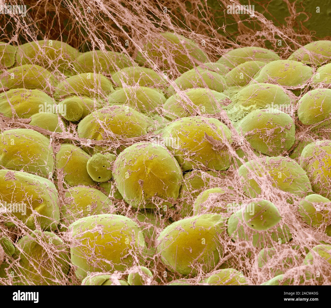 Fat tissue. Coloured scanning electron micrograph (SEM) of fat cells