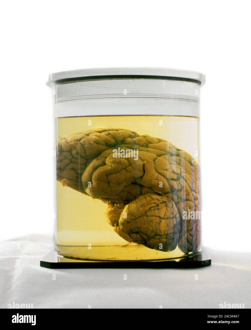 Preserved human brain in a specimen jar Stock Photo Alamy