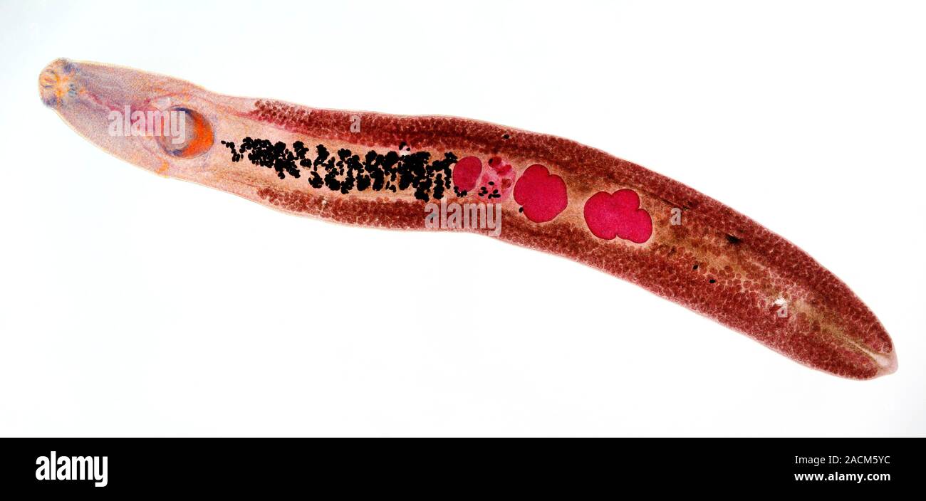 Fluke worm. Light micrograph of a section through an Echinostoma