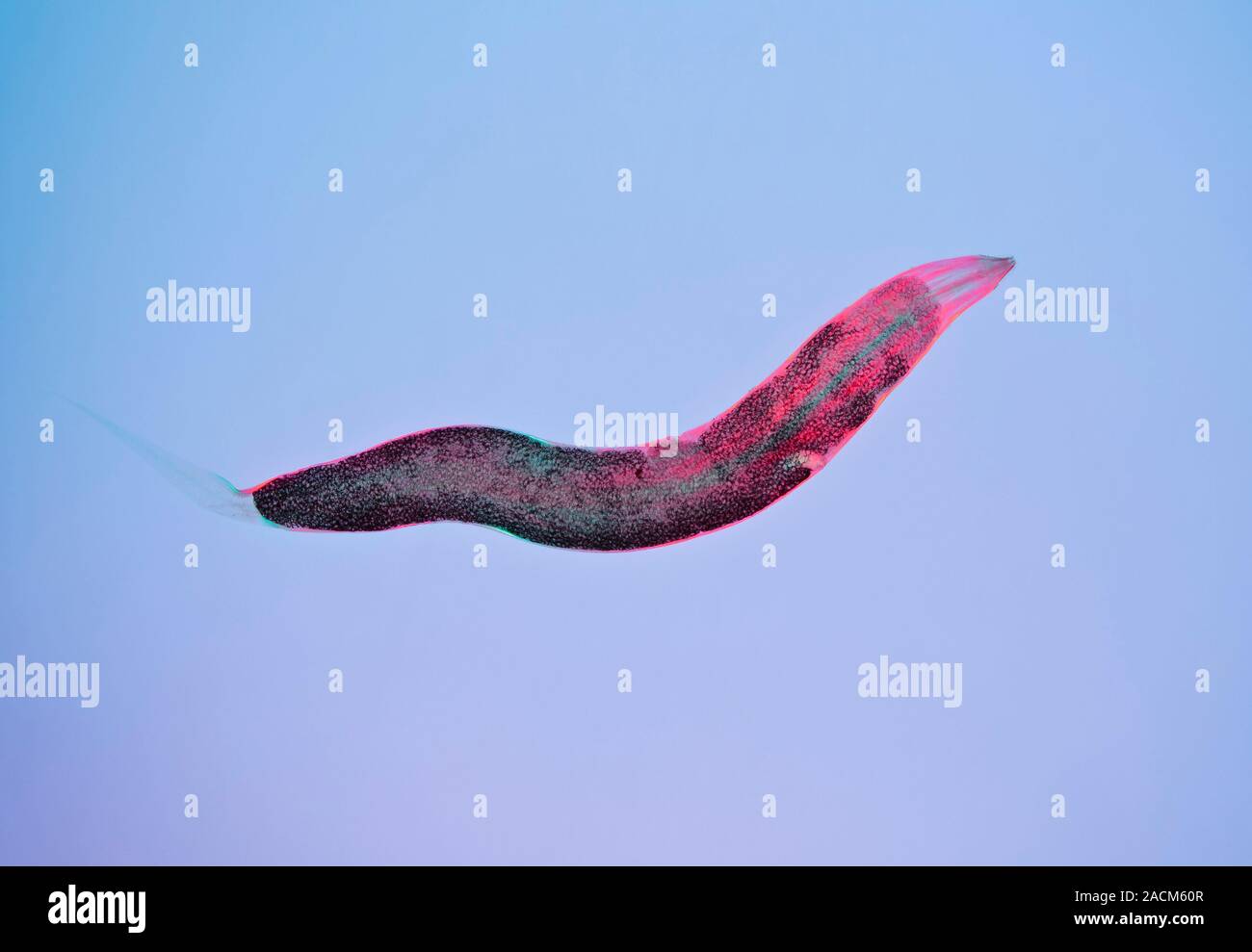 Threadworm. Light micrograph of a female Enterobius vermicularis