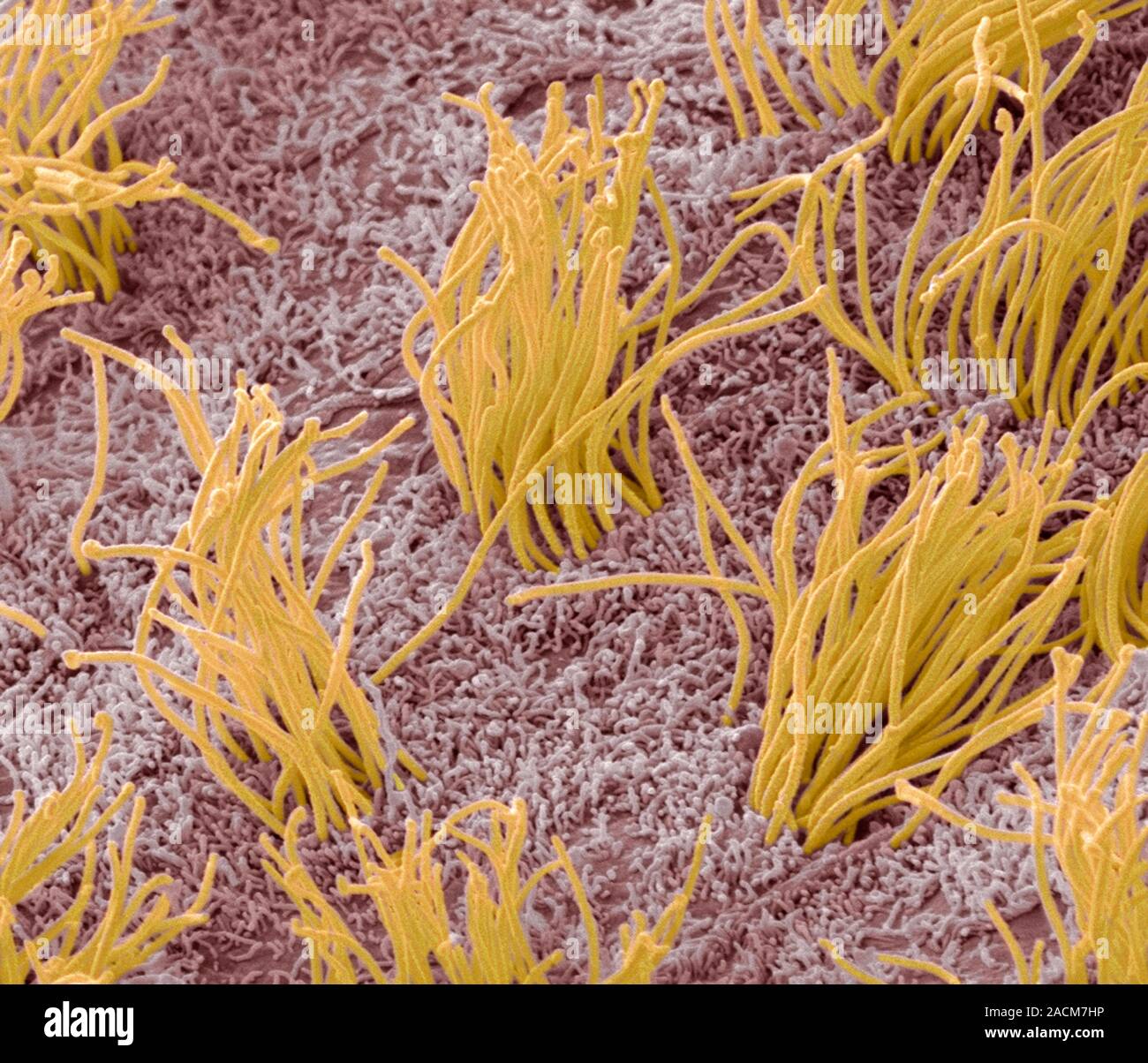 Brain lining. Coloured scanning electron micrograph (SEM) of the lining ...