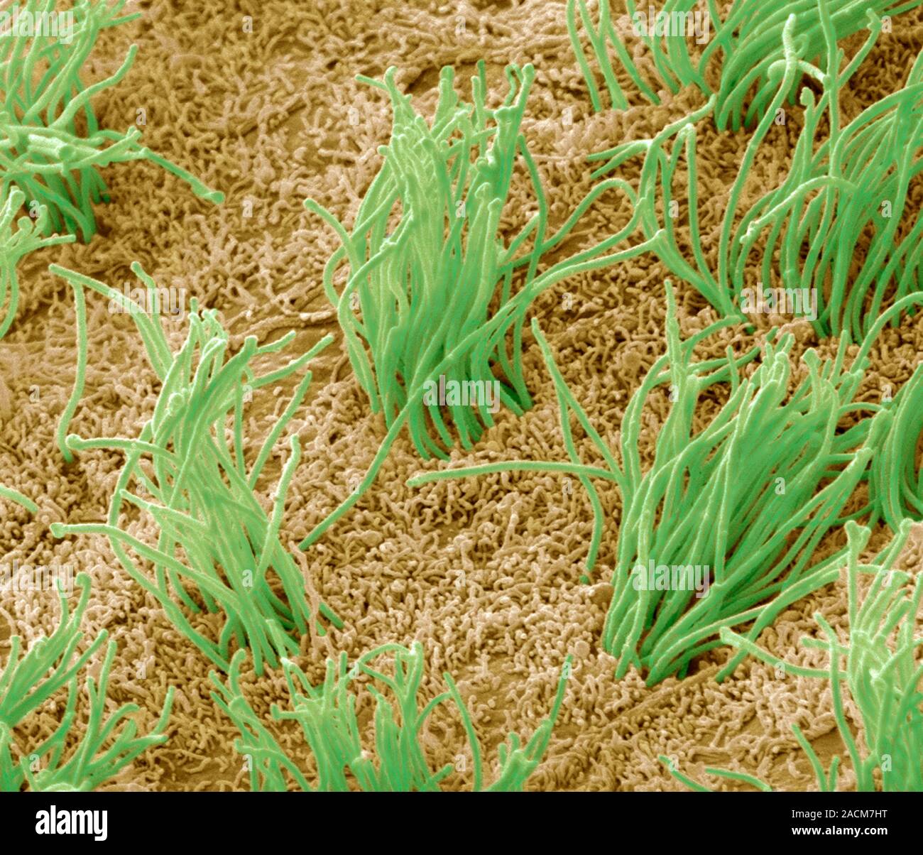 Brain lining. Coloured scanning electron micrograph (SEM) of the lining ...