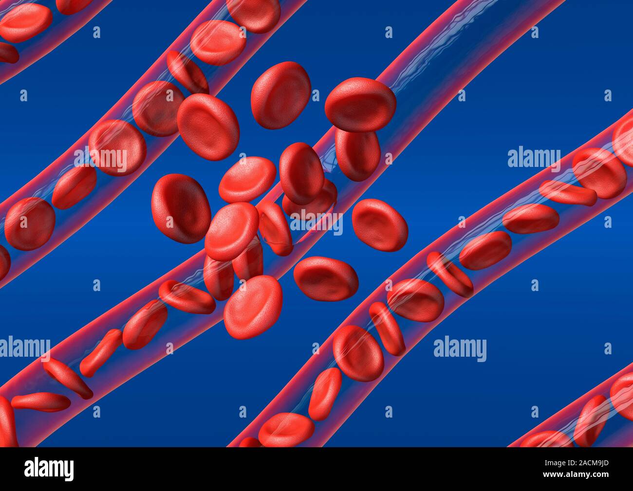 Burst blood vessel. Computer artwork of red blood cells bursting out of