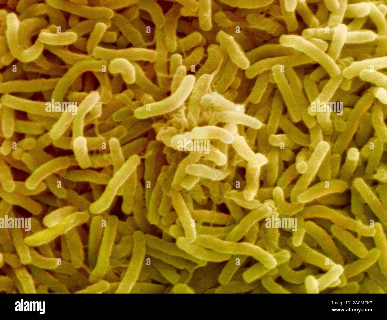 Желтые бактерии. Микроорганизмы желтые. Бактерии желтого цвета. Желтые бактерии с ложноножками.