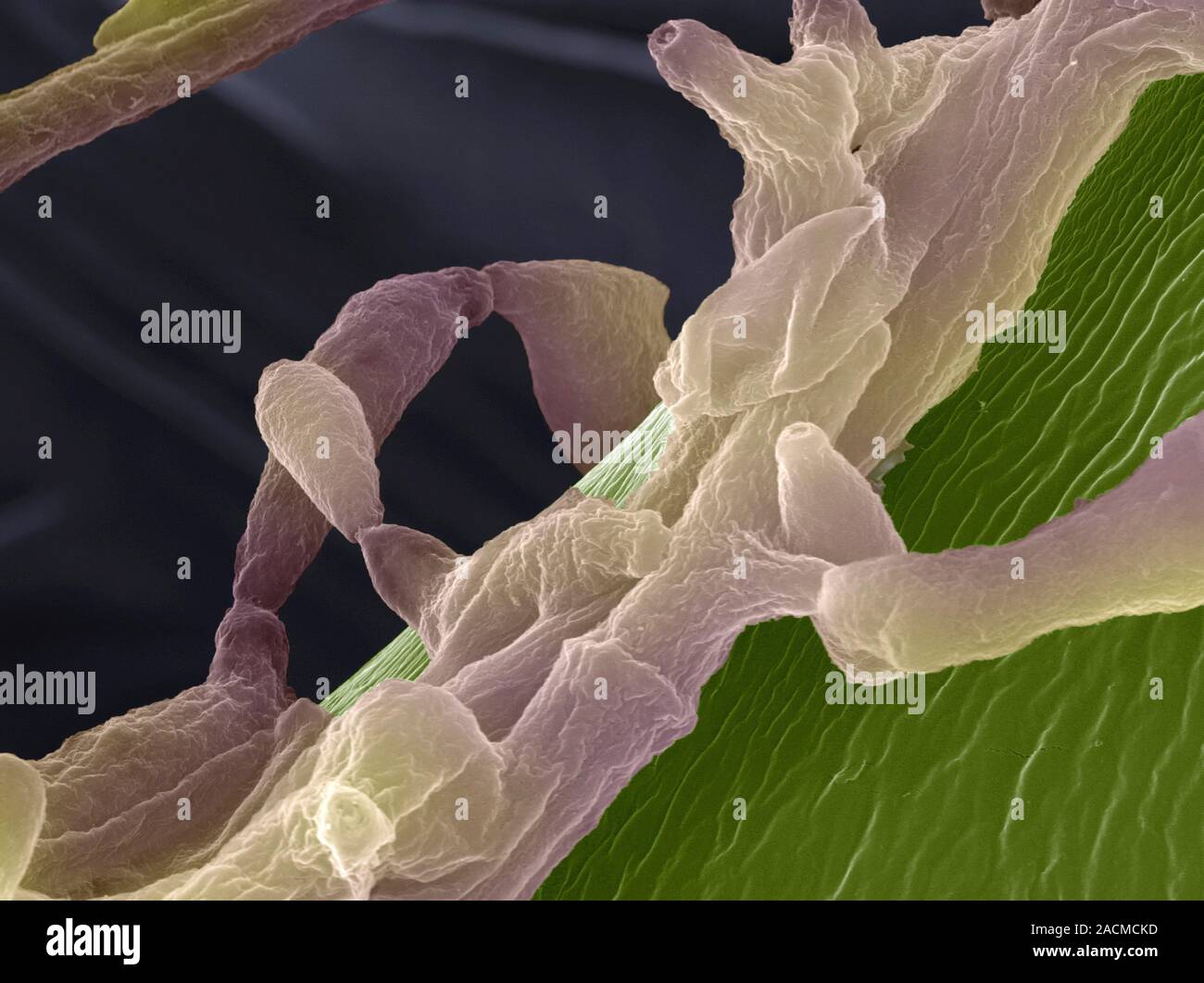 Hypha Tree Apple tree fungus. Coloured scanning electron micrograph (SEM) of ...