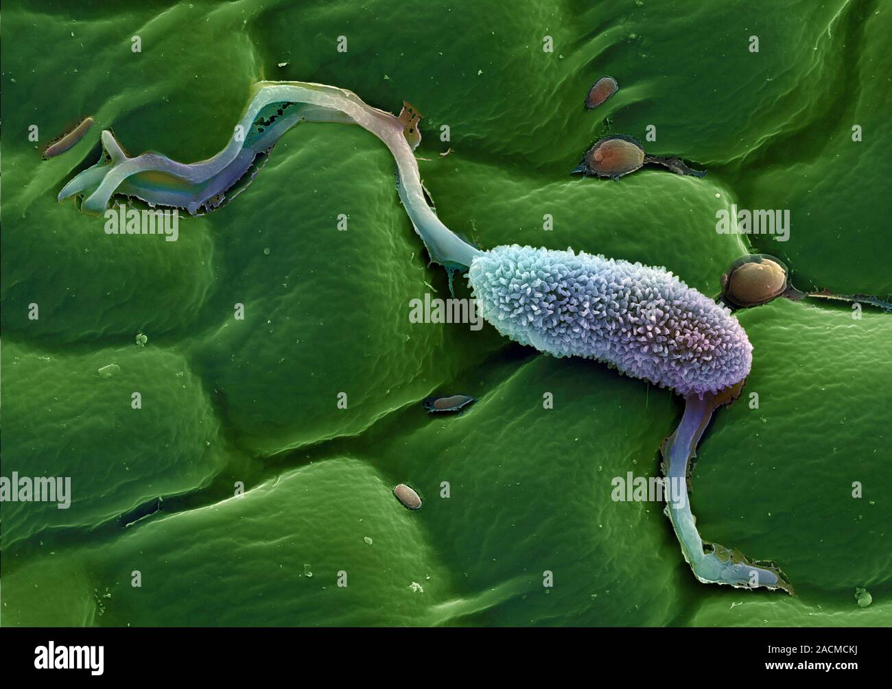бактерии растений. сапрофитные почвенные бактерии. микроорганизмы растений. микроорганизмы растений. бактерия escherichia coli.