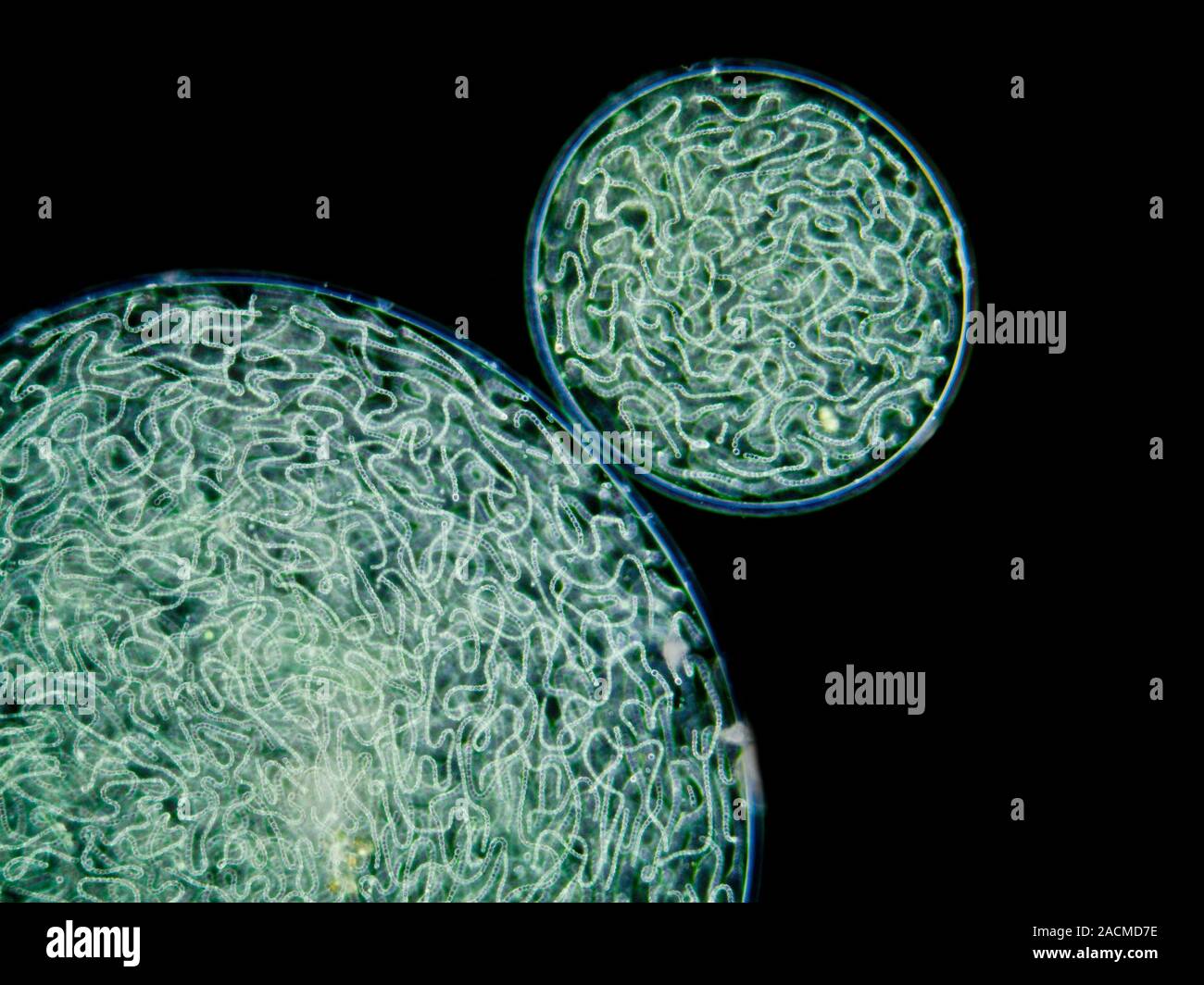 Nostoc cyanobacteria. Darkfield contrast micrograph of a mass of Nostoc