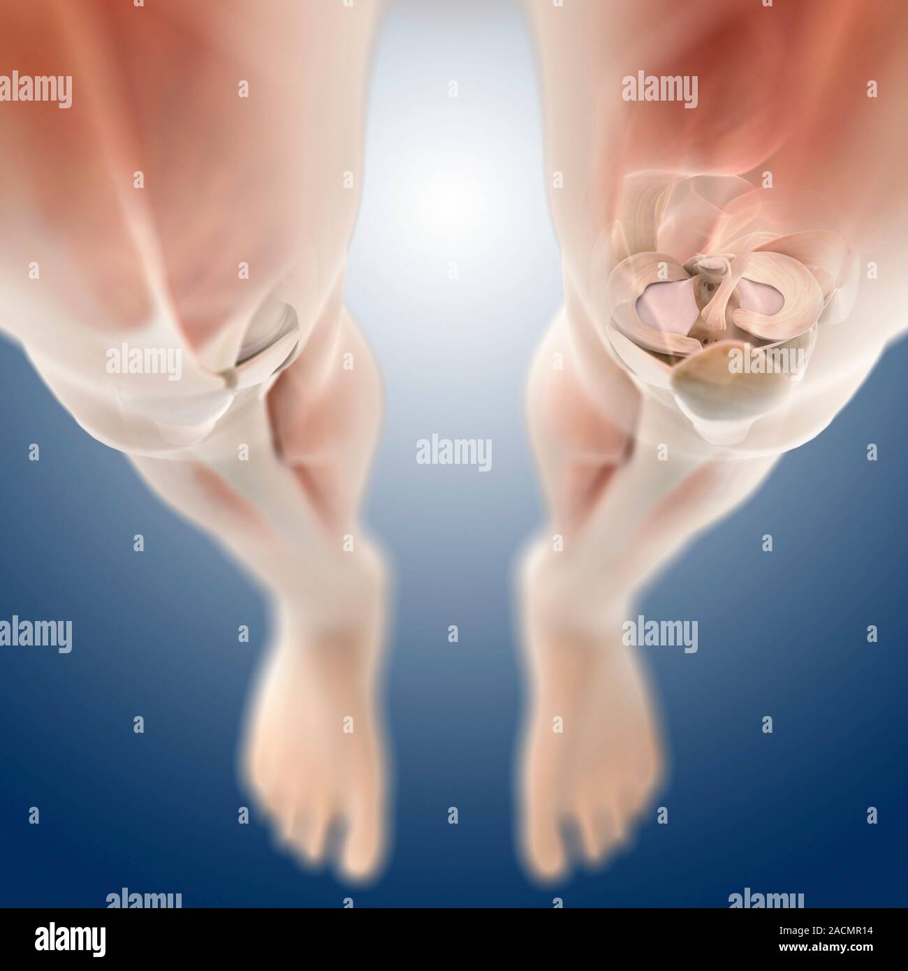 Tibia In Leg Knee anatomy. Computer artwork of the legs, showing cartilage ...