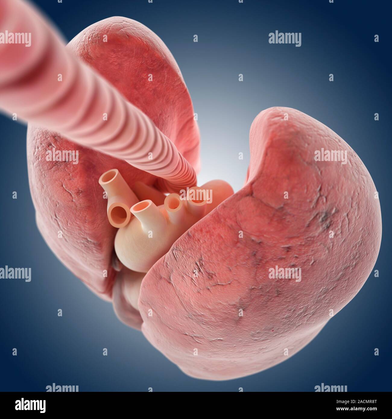 Windpipe Collapse Heart and lungs. Computer artwork showing the trachea (windpipe, top ...