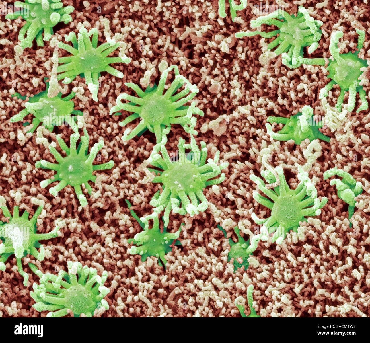Nasal lining. Coloured scanning electron micrograph (SEM) of the ...