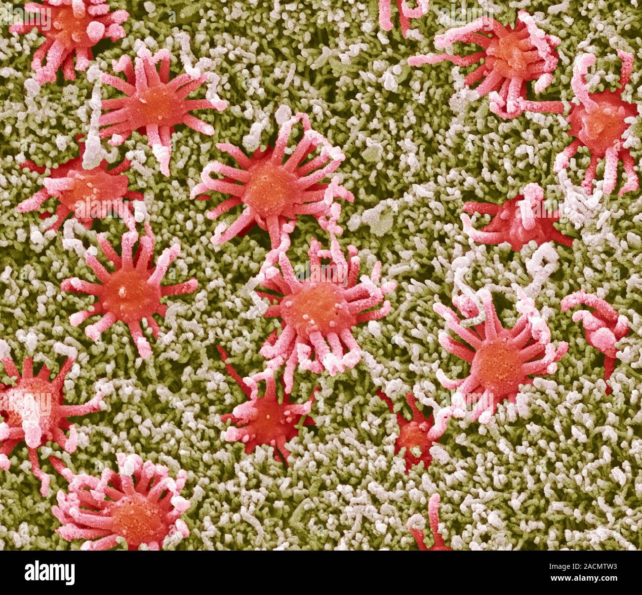 Nasal lining. Coloured scanning electron micrograph (SEM) of the ...
