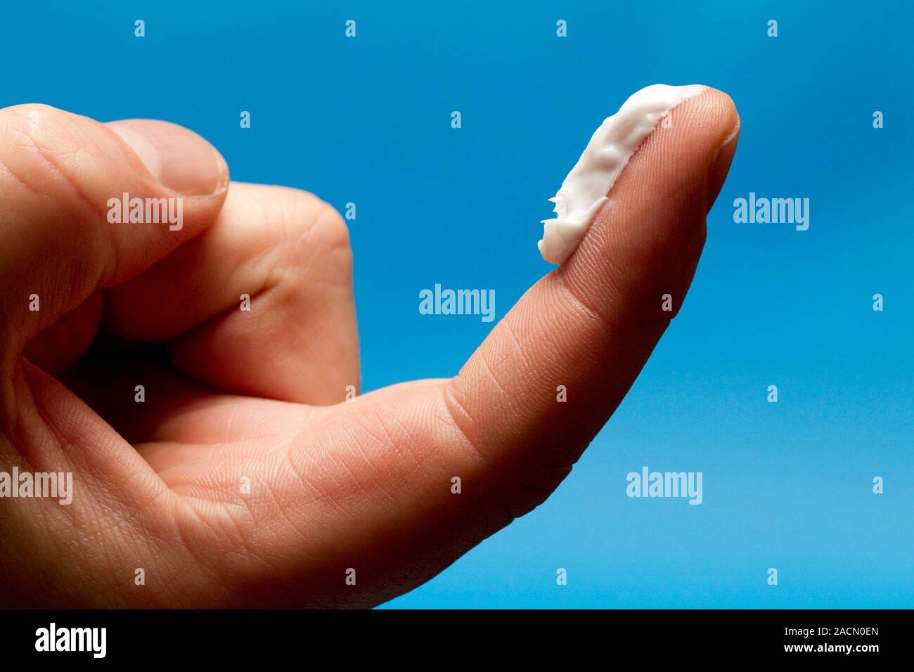 Fingertip unit of cream. A fingertip unit (FTU) is the amount of cream