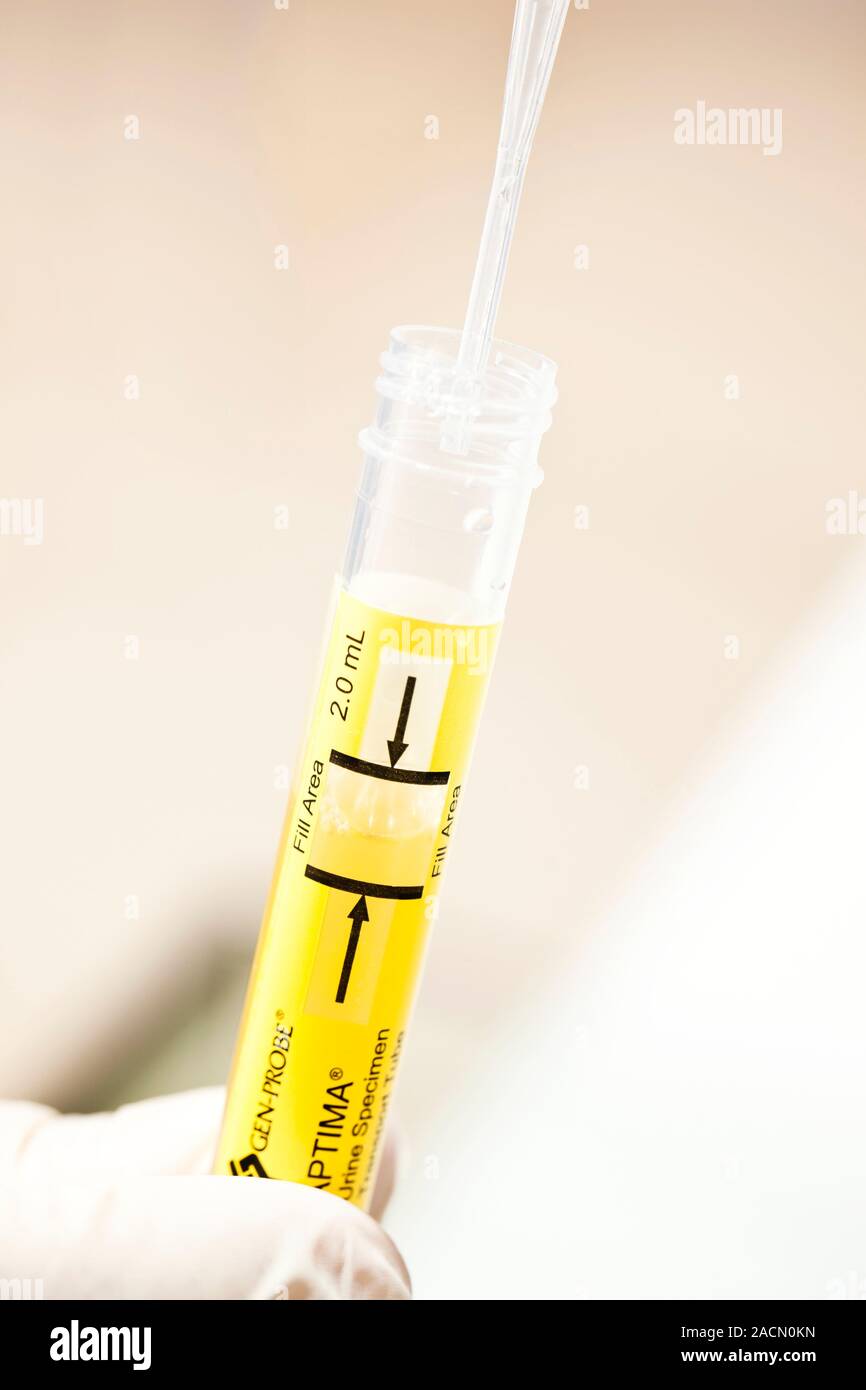 Urine chlamydia test. Urine being added to a tube in which a test will ...