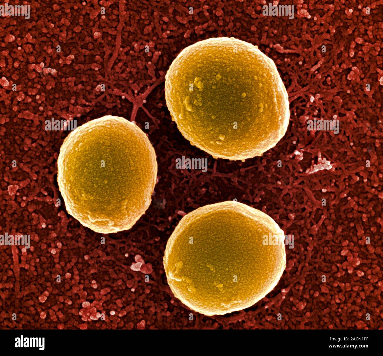 1 staphylococcus aureus