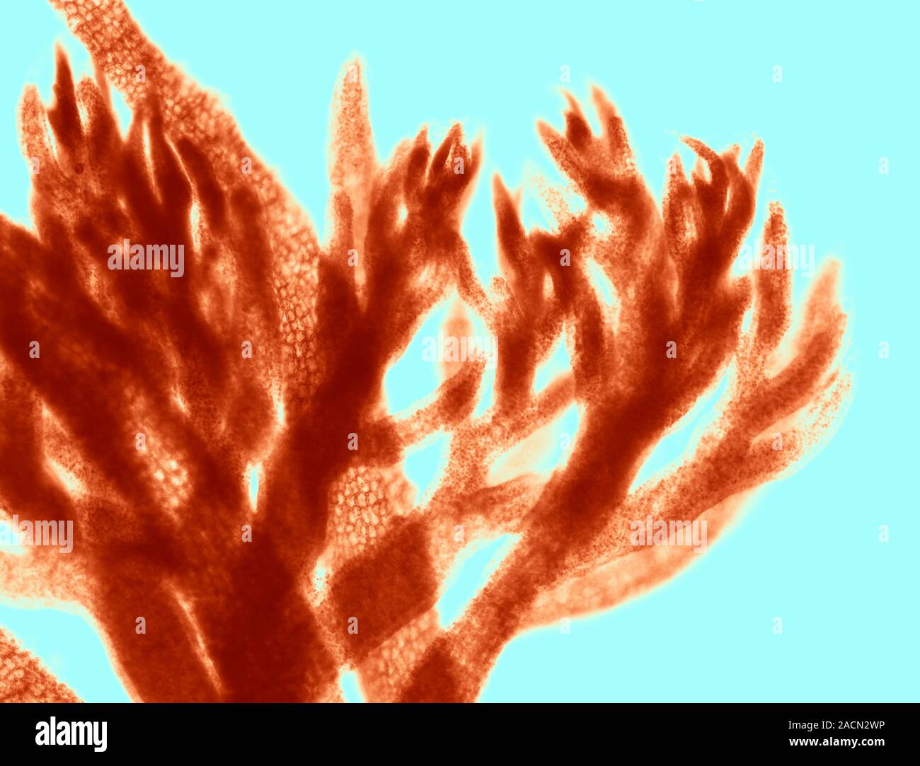 Красные водоросли клетки. Полисифония водоросль. Polysiphonia antheridia. Эктокарпус водоросль. Красные водоросли в косметологии.