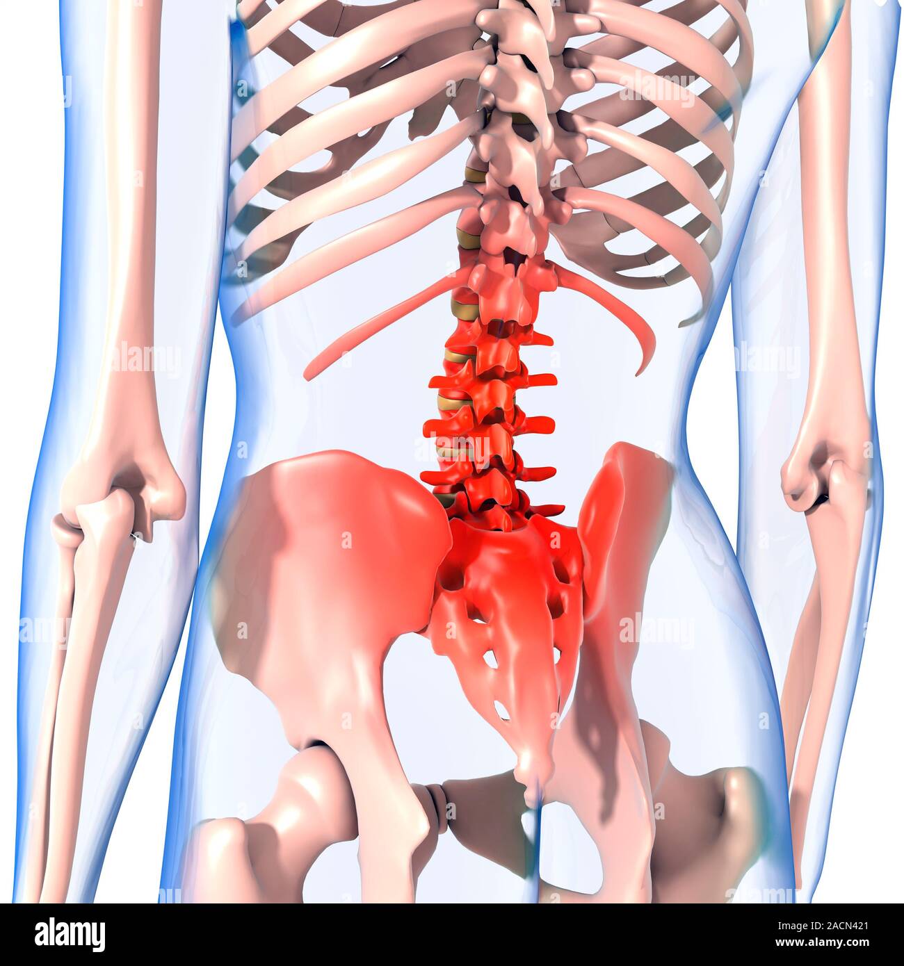 Lower back pain, computer artwork Stock Photo - Alamy