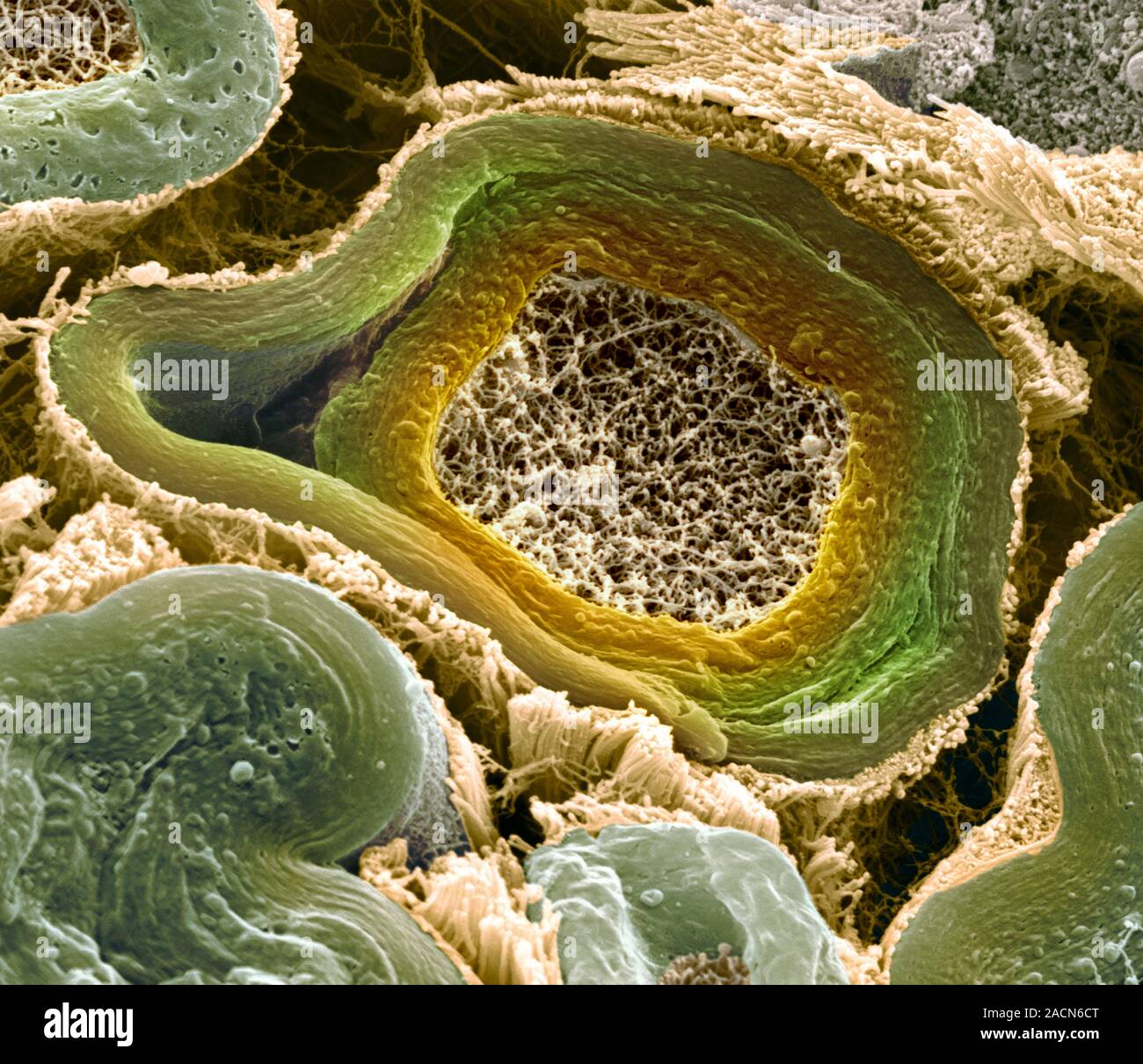 Myelinated Nerves Coloured Scanning Electron Micrograph Sem Of A Hot Sex Picture