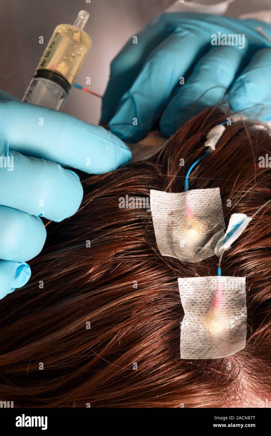 Electroencephalography. Neurologist placing electroencephalography (EEG