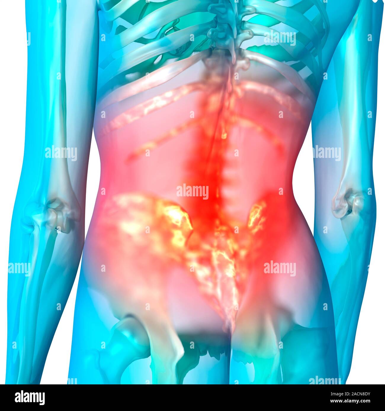 Lower back pain, computer artwork Stock Photo - Alamy