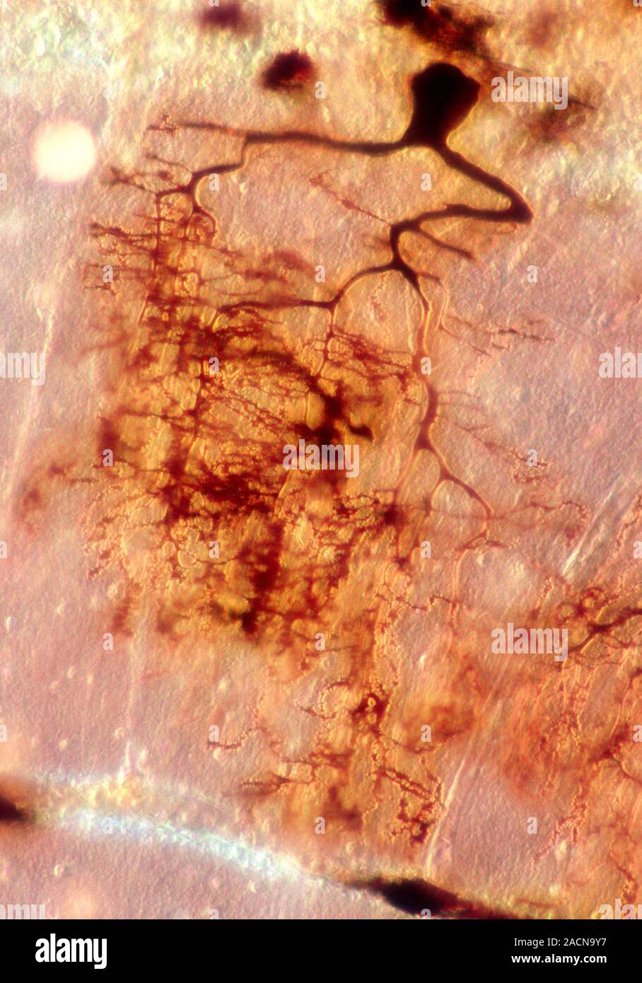 Purkinje nerve cell. Light micrograph of a purkinje nerve cell (black ...