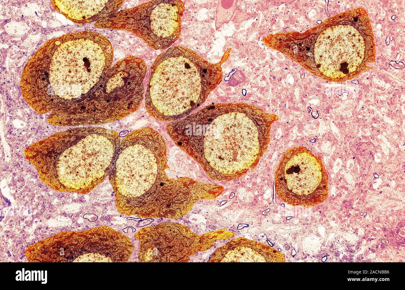 Tem Brain Brain nerve cells. Transmission electron micrograph (TEM) of a section ...