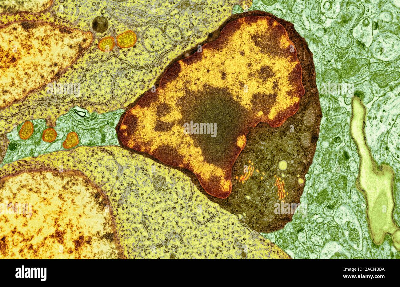 Tem Brain Brain cell. Transmission electron micrograph (TEM) of a section through ...