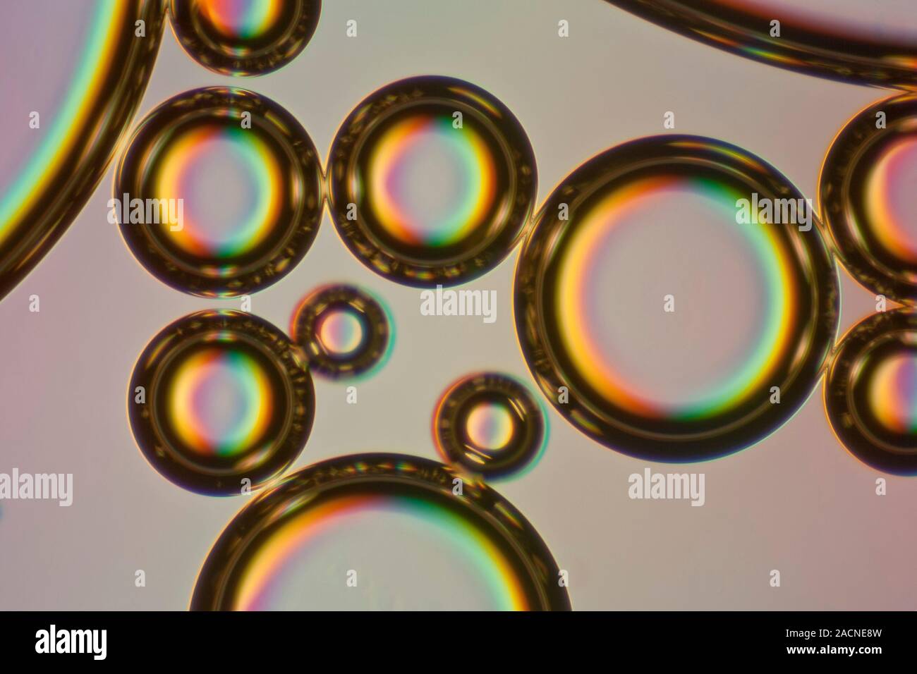 Пузырек воздуха в легком. Пузырьки воздуха под микроскопом. Газировка под микроскопом. Пиво под микроскопом. Частицы круглые микроскоп.