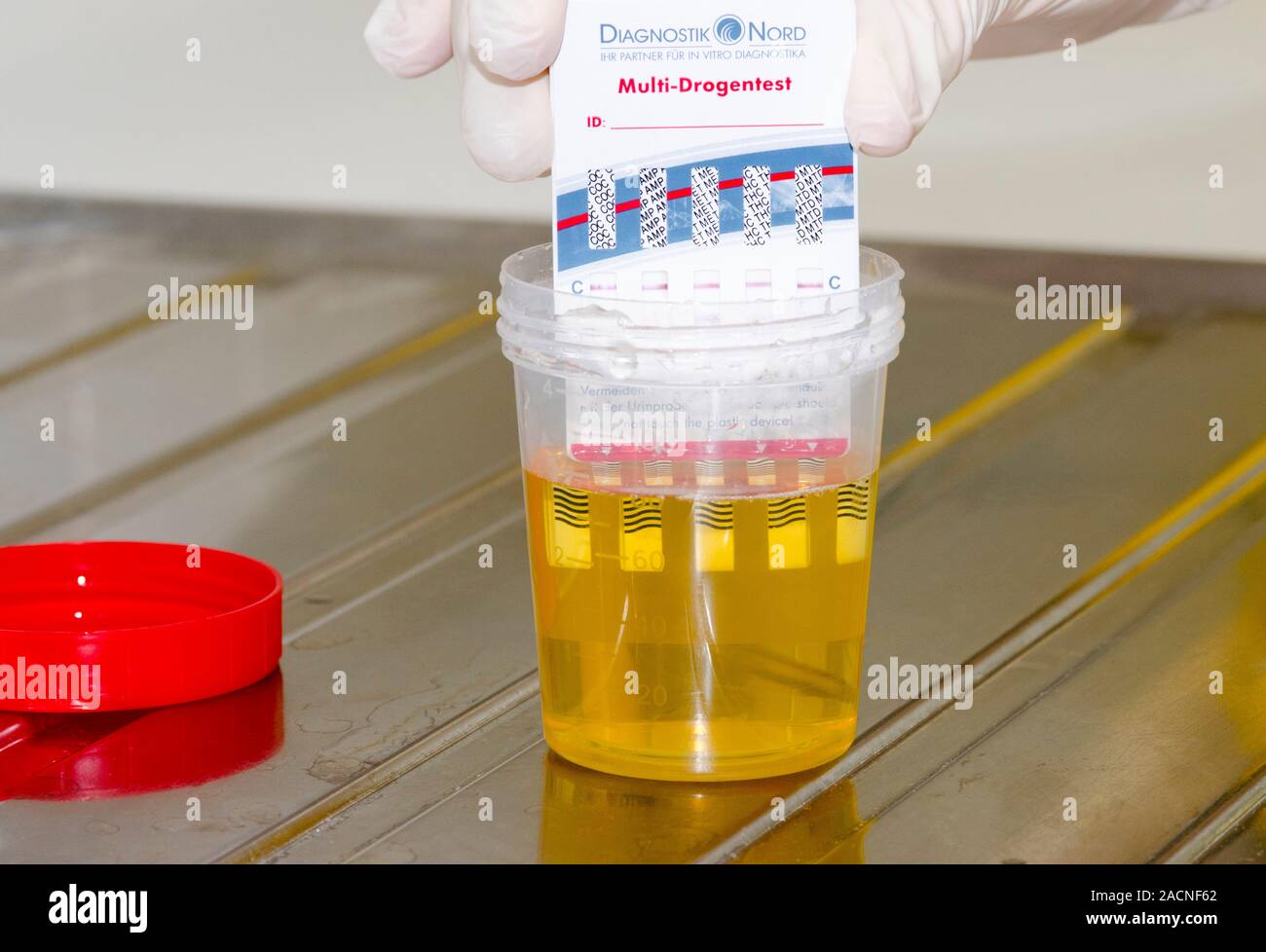 Urine drug test. Drug test card being dipped into a sample of urine to