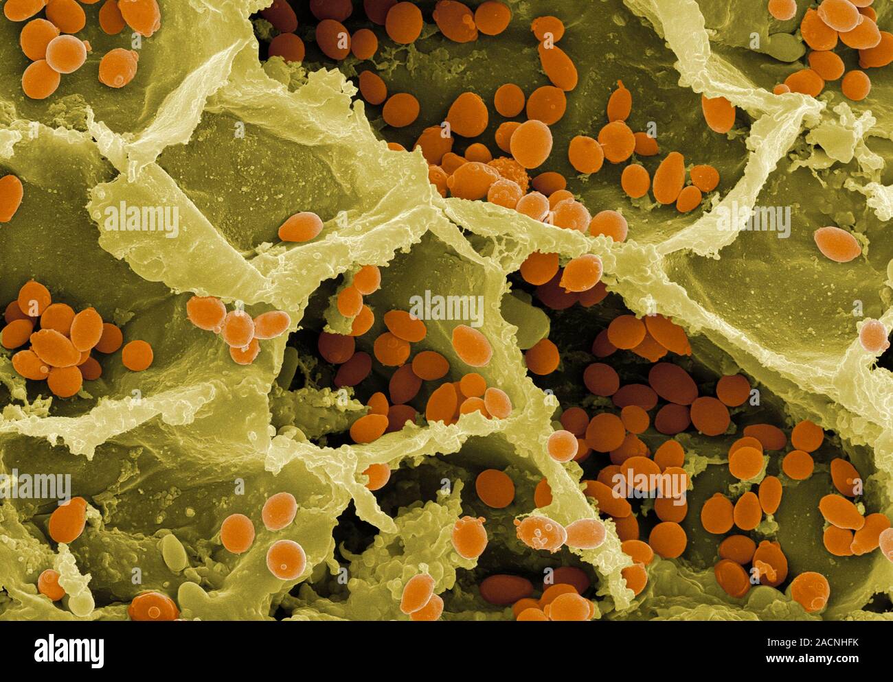 Yeast on a grape. Coloured scanning electron micrograph (SEM) of yeast