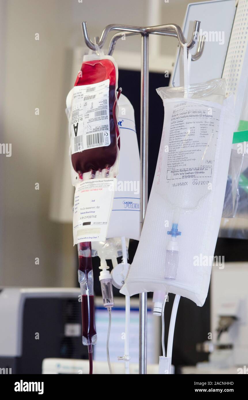 Blood transfusion. Closeup various bags of drugs and blood being