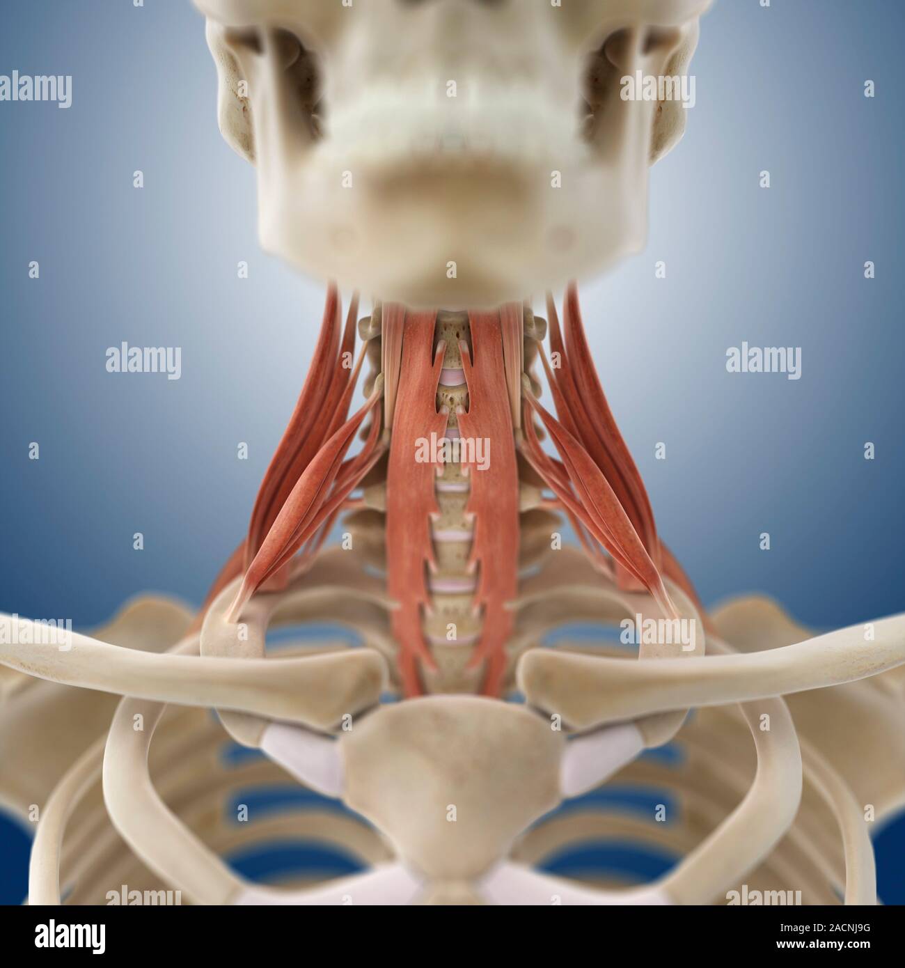 My Image 10