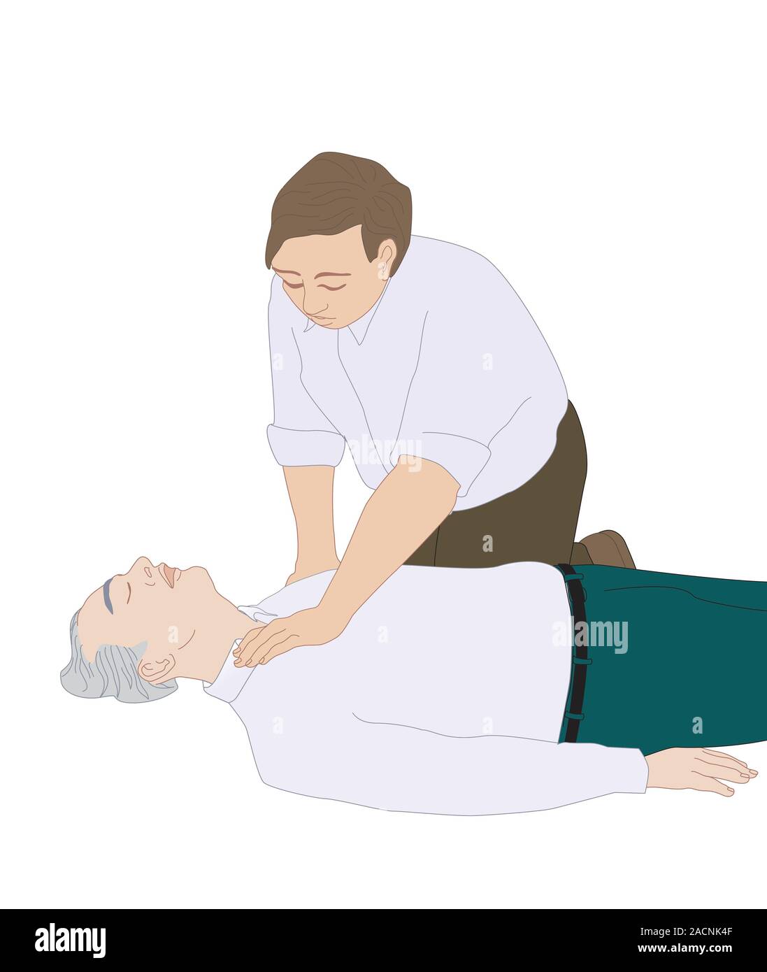 CPR first aid technique. Artwork showing the 1st of 6 steps used in the