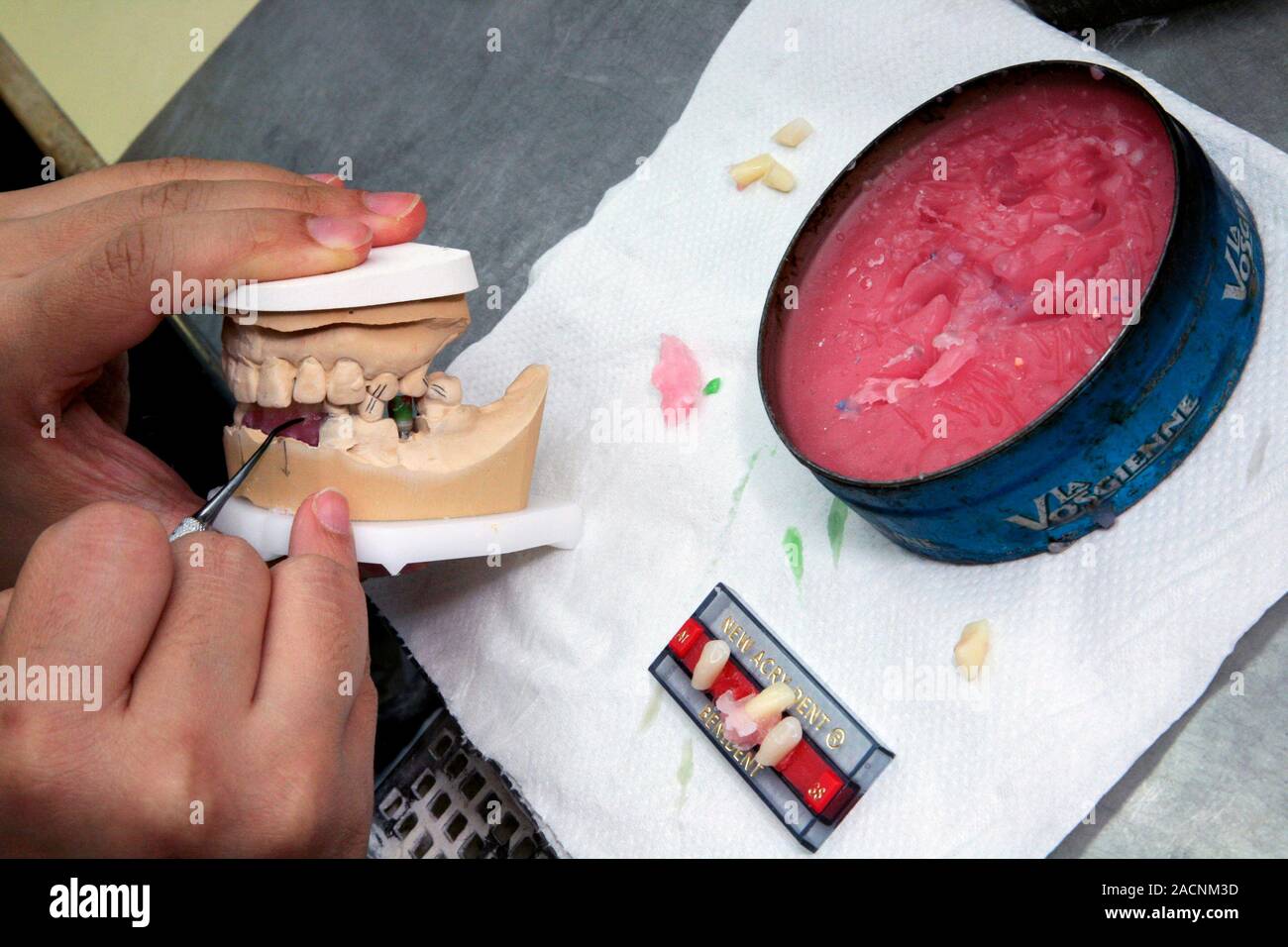 Dental prosthesis production. Worker making custom dental prosthetics. Photographed at the