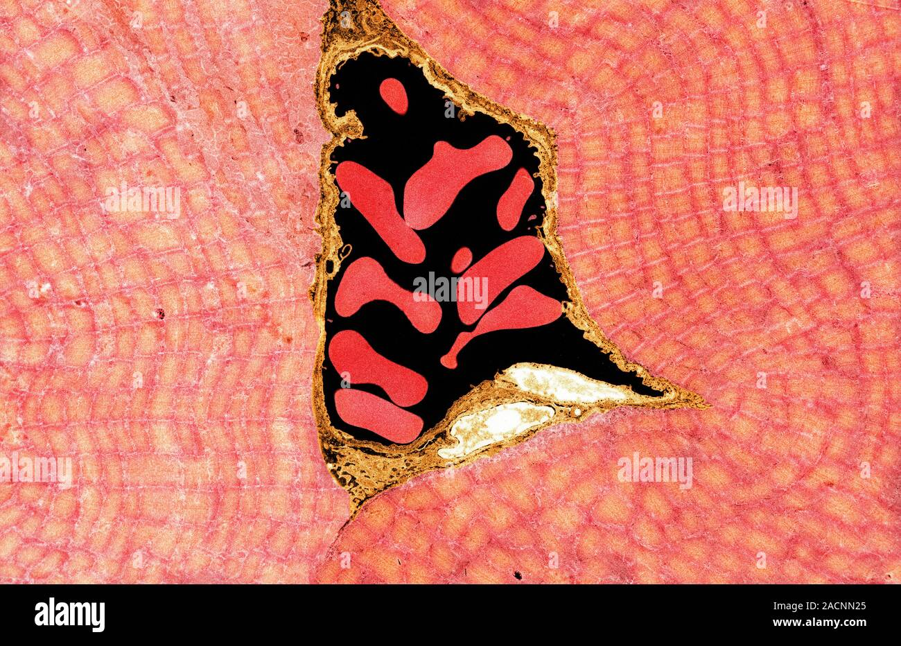 Muscle arteriole. Transmission electron micrograph (TEM) of a section ...