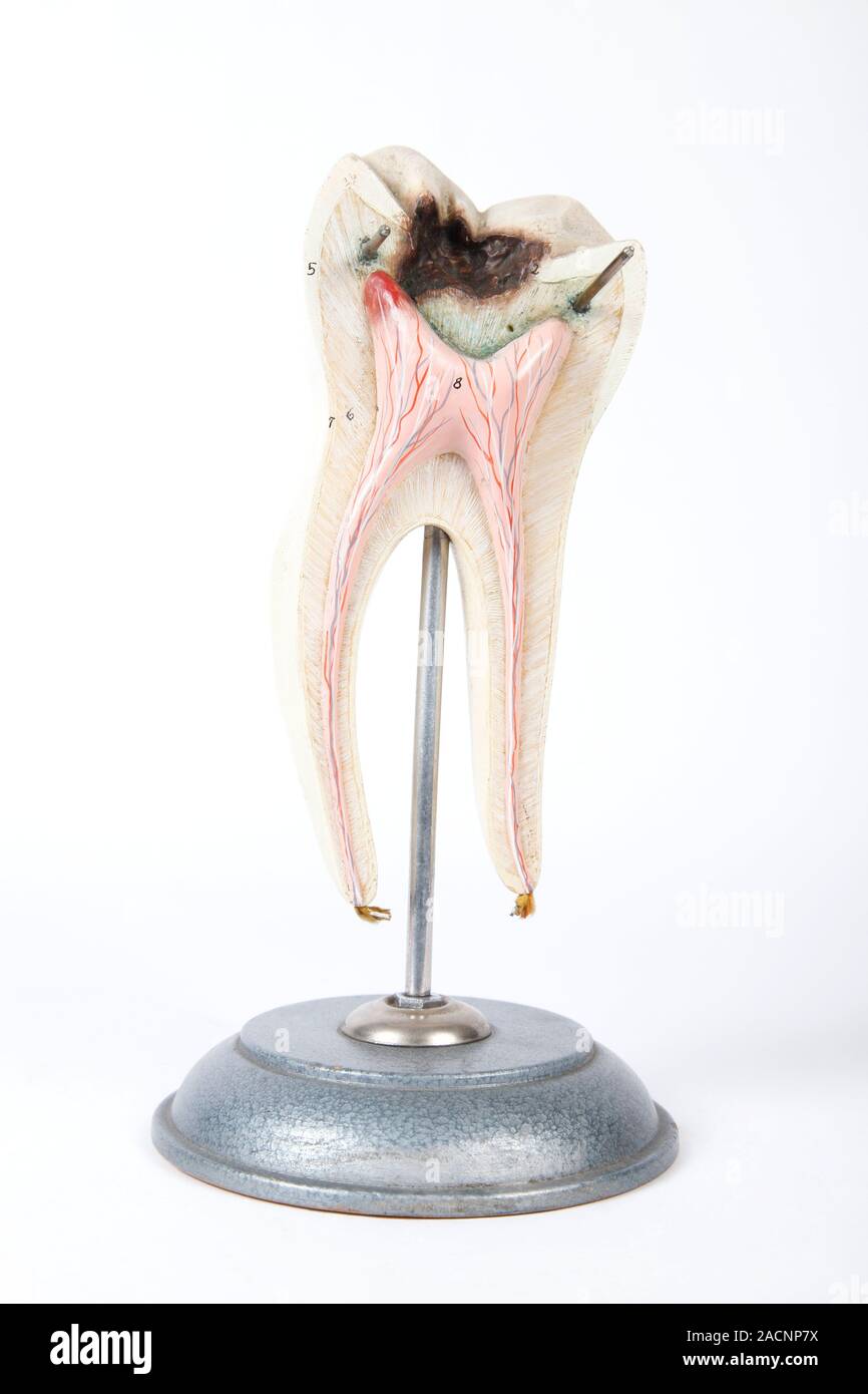 Human tooth. 1950s model of a section through a human molar tooth ...